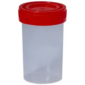 Urocultor steril 60 ml, Smart